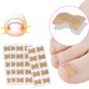 Desencrava® - Adesivo Corretor de Unha | + BRINDE 50 Unidades GRATUITAS